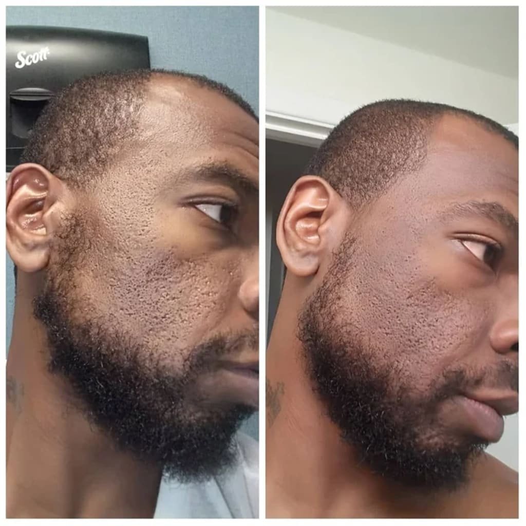 Glas-Haut Premium-Kit (6 Stück) – Bild 6